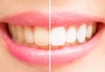 Figure out How to Pick the Right Toothbrush for You